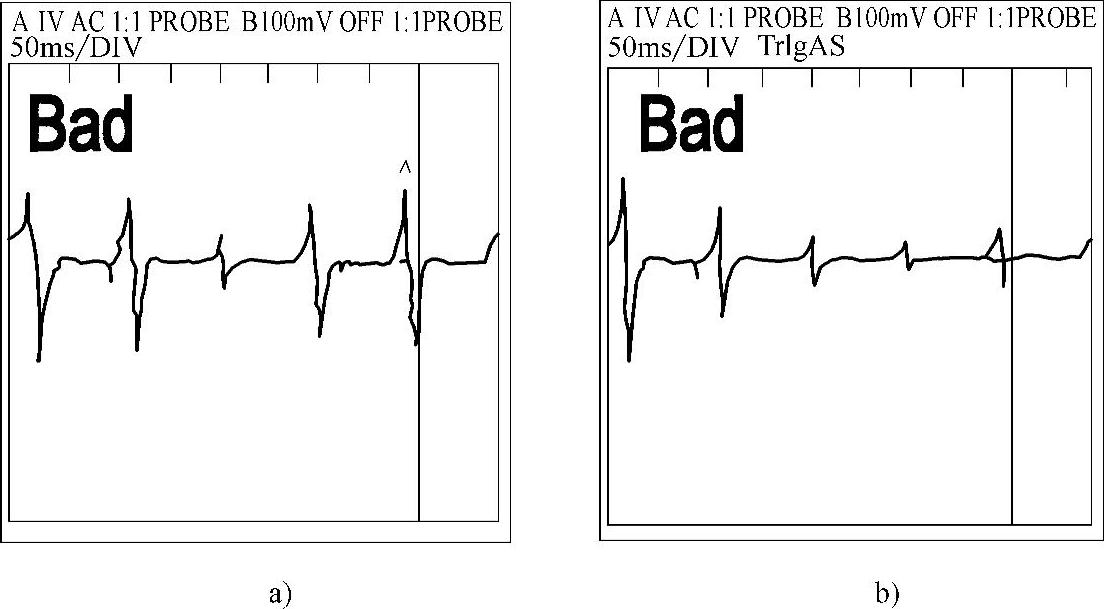 978-7-111-40618-1-Chapter11-14.jpg